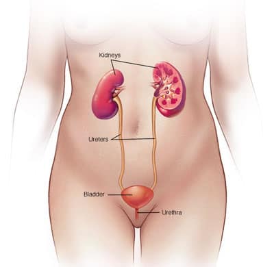 urinary tract infection treatment in Delhi