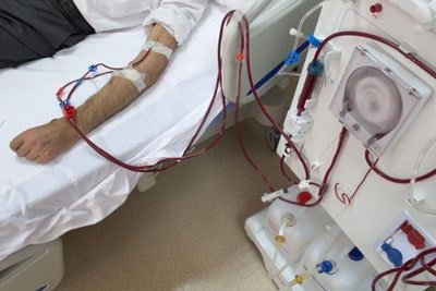 acute-renal-failure-treatment-in-delhi